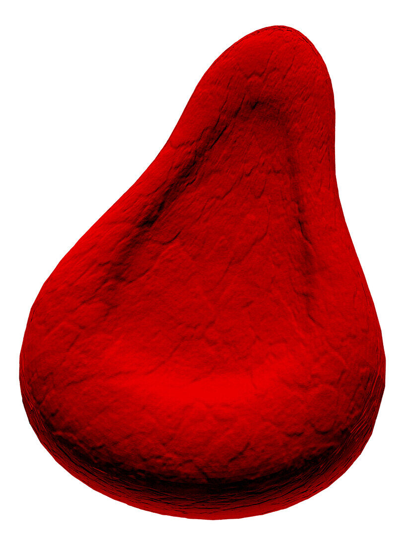 Teardrop cell abnormal red blood cell, illustration