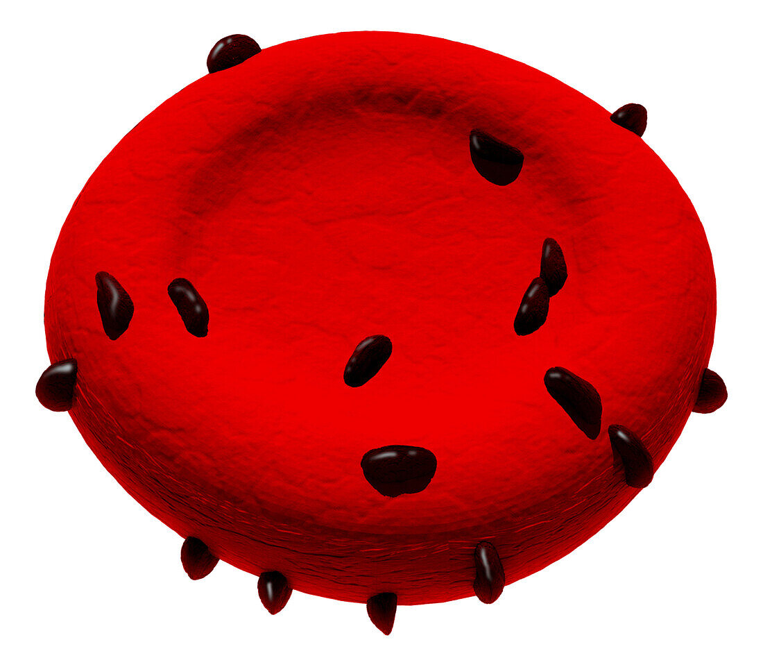 Siderocyte abnormal red blood cell, illustration