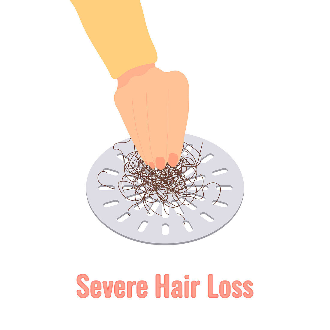 Severe hair loss, conceptual illustration