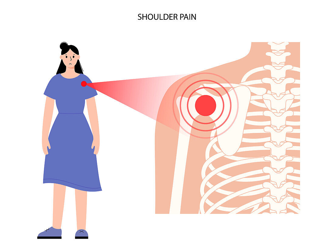 Shoulder pain, conceptual illustration