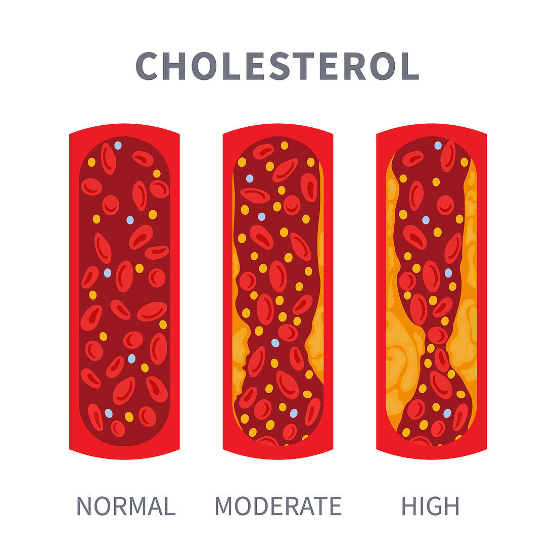 Cholesterol levels, conceptual illustration