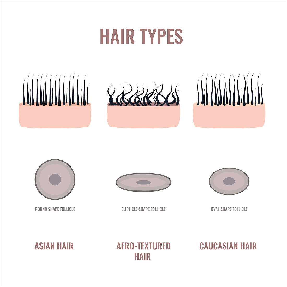 Hair types, conceptual illustration