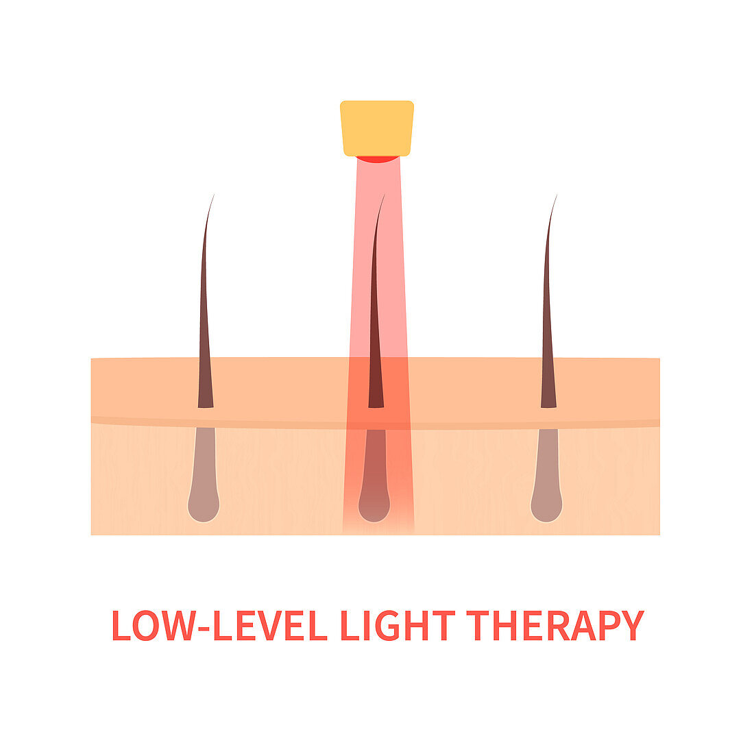 Light therapy, conceptual illustration