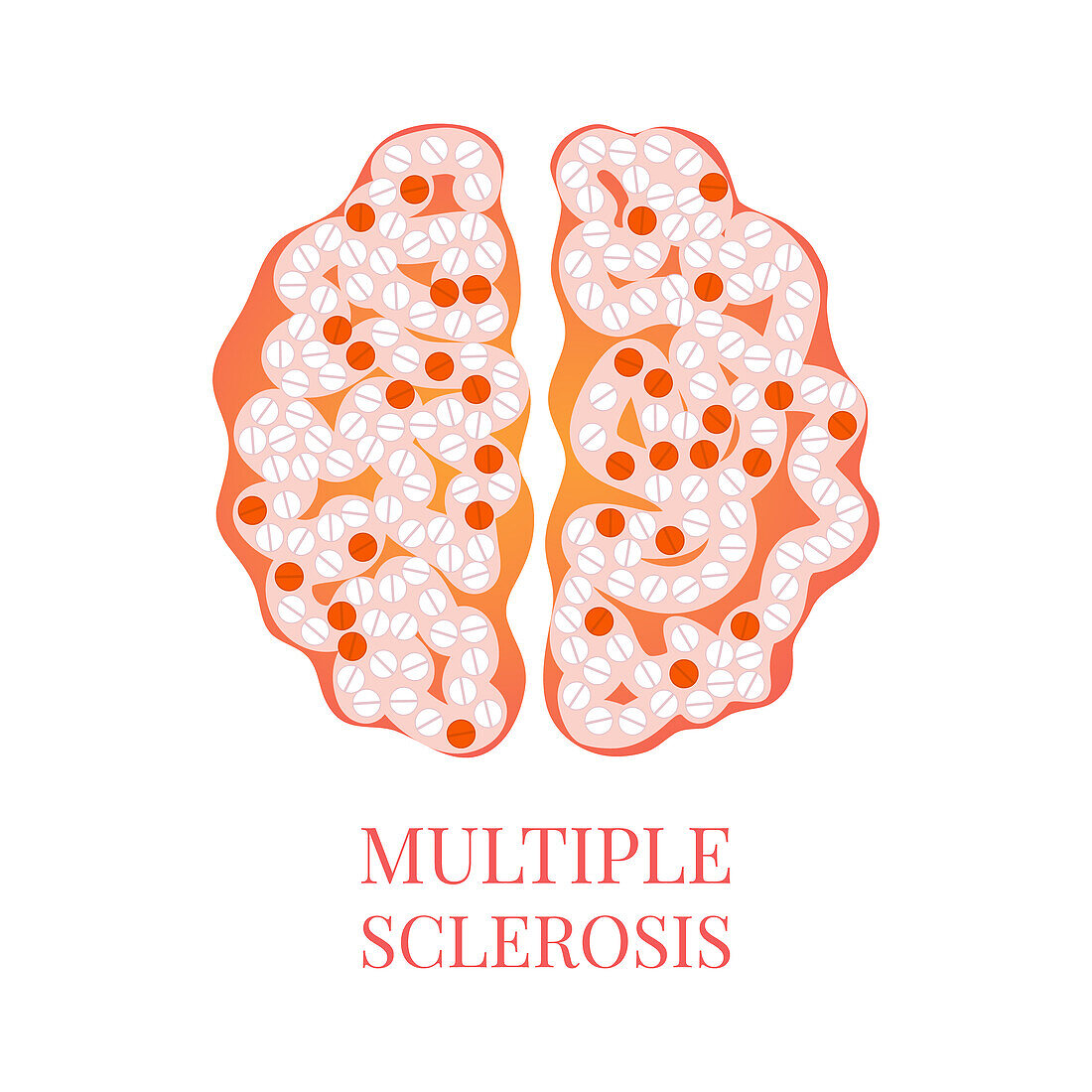 Multiple sclerosis, conceptual illustration