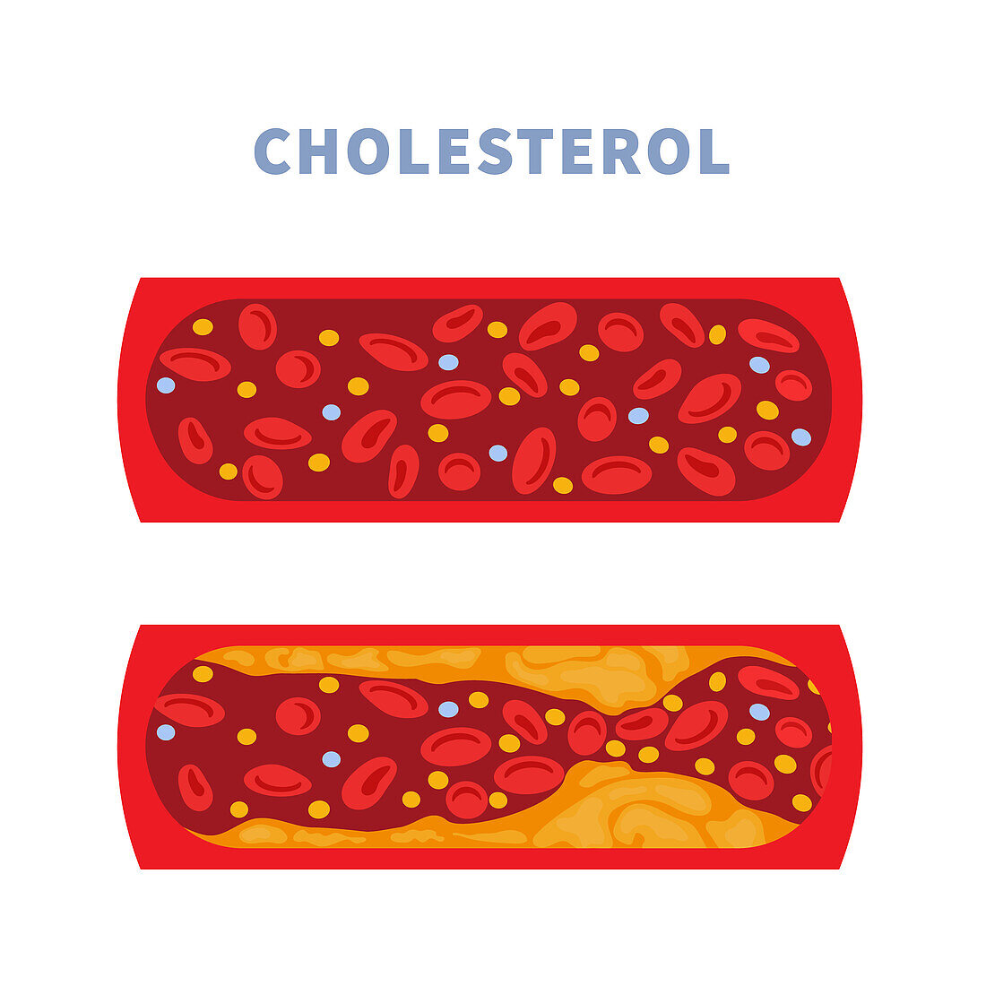 Artery health, conceptual illustration