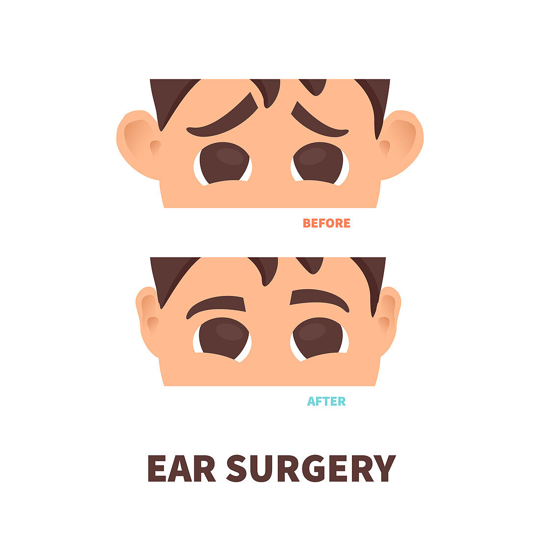 Ear surgery, conceptual illustration