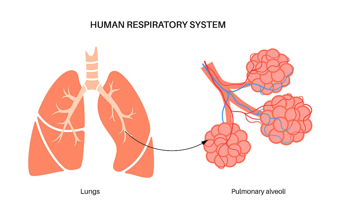 Lung diseases, illustration