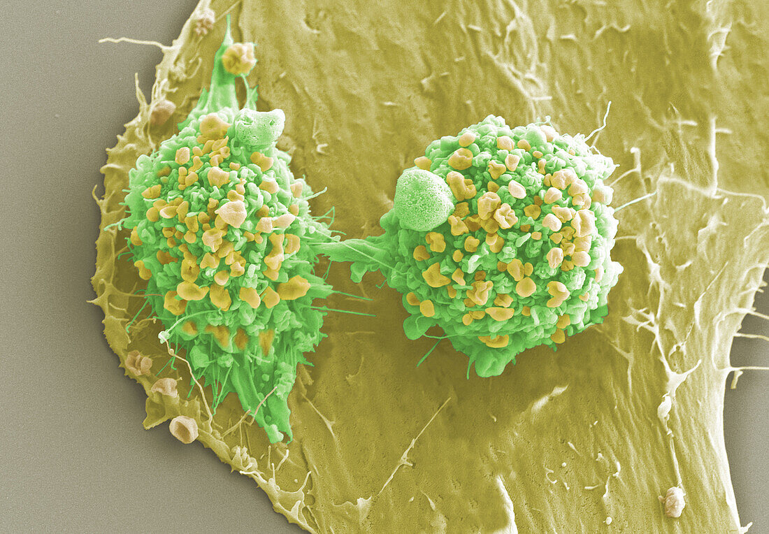 Cervical cancer cells dividing, SEM