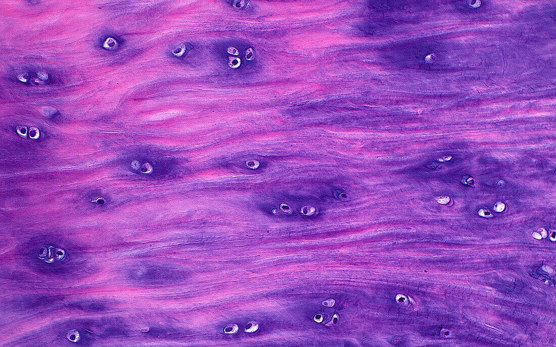 Hyaline cartilage, light micrograph