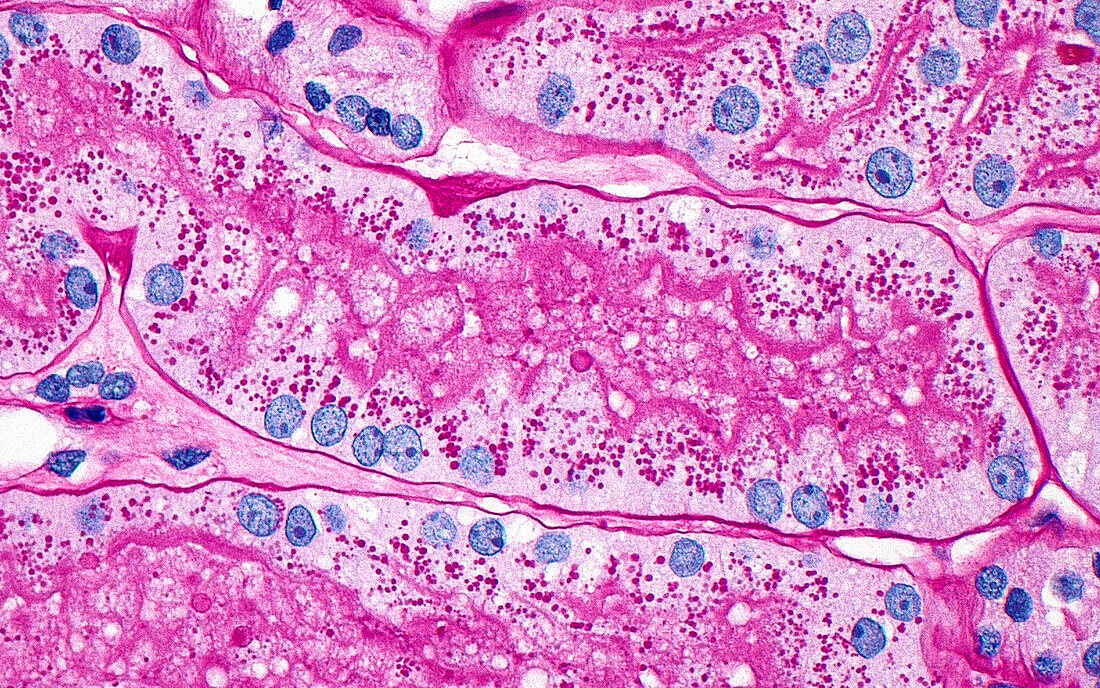 Proximal kidney tubules, light micrograph