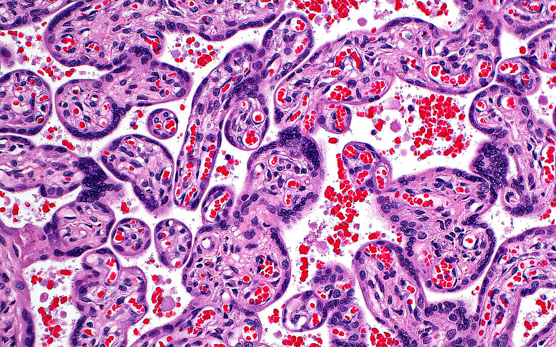 Placenta villi, light micrograph