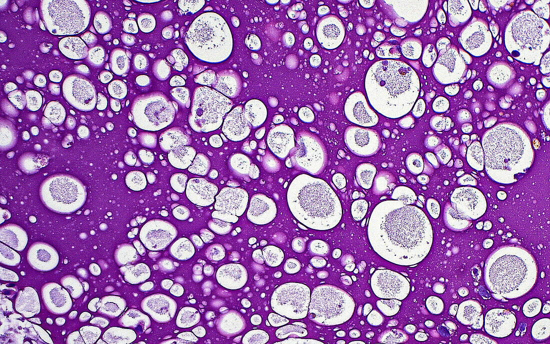 Seminal vesicle secretions, light micrograph