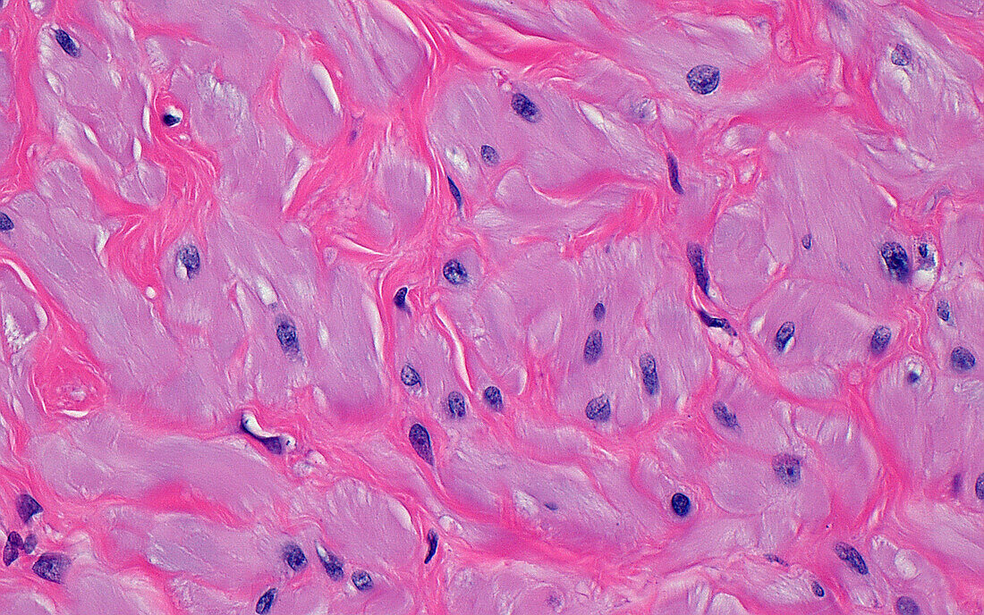 Vas deferens smooth muscle, light micrograph
