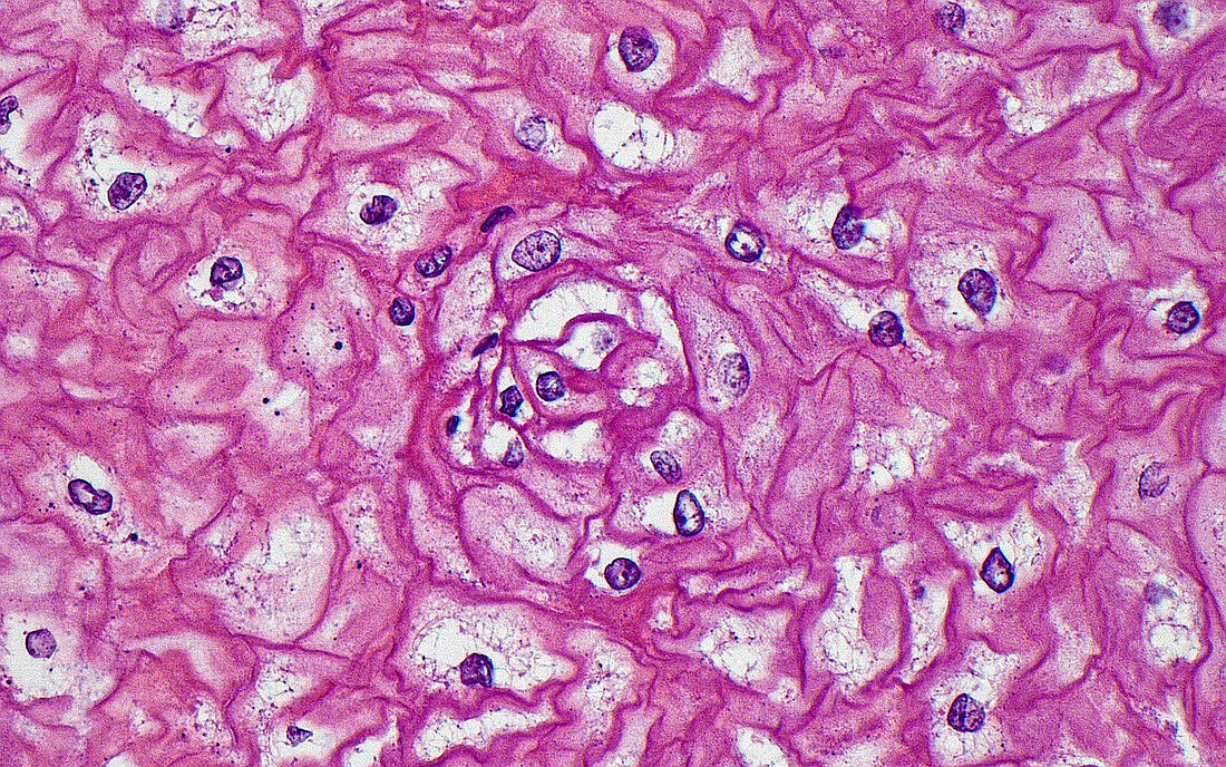 Oesophagus squamous cells, light micrograph