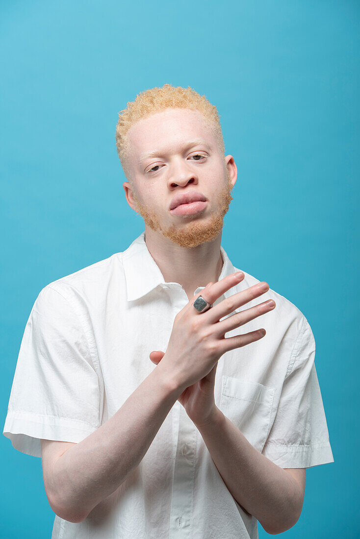 Studio portrait of albino man in white shirt