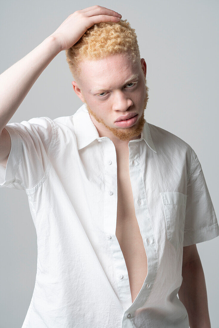 Studio portrait of albino man in white shirt