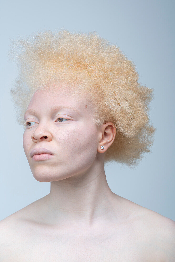 Studio portrait of albino woman