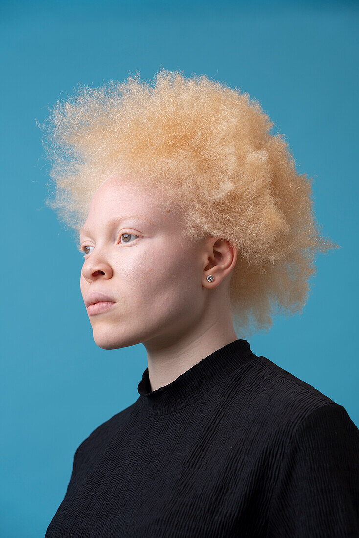 Studio-Porträt einer Albino-Frau