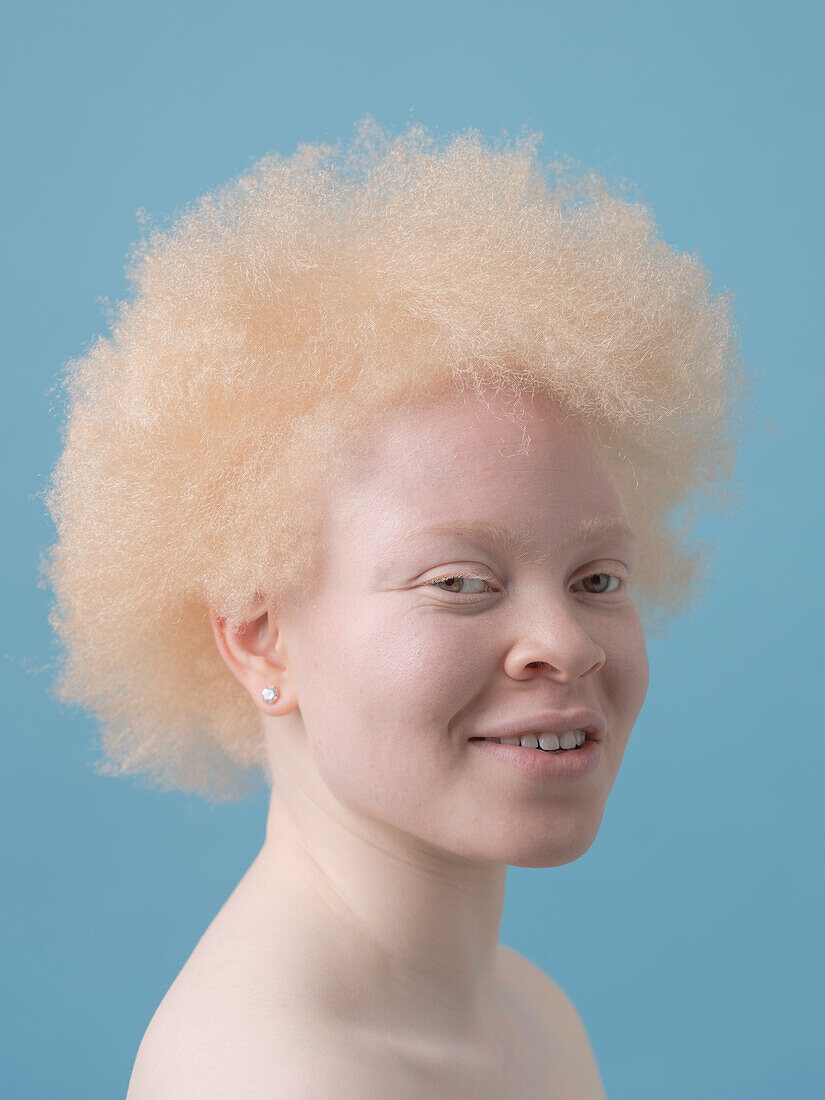 Studioporträt einer lächelnden Albino-Frau