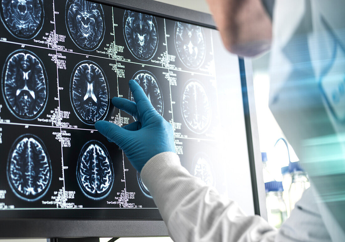 Ein Arzt analysiert den Gehirnscan eines Patienten auf dem Bildschirm