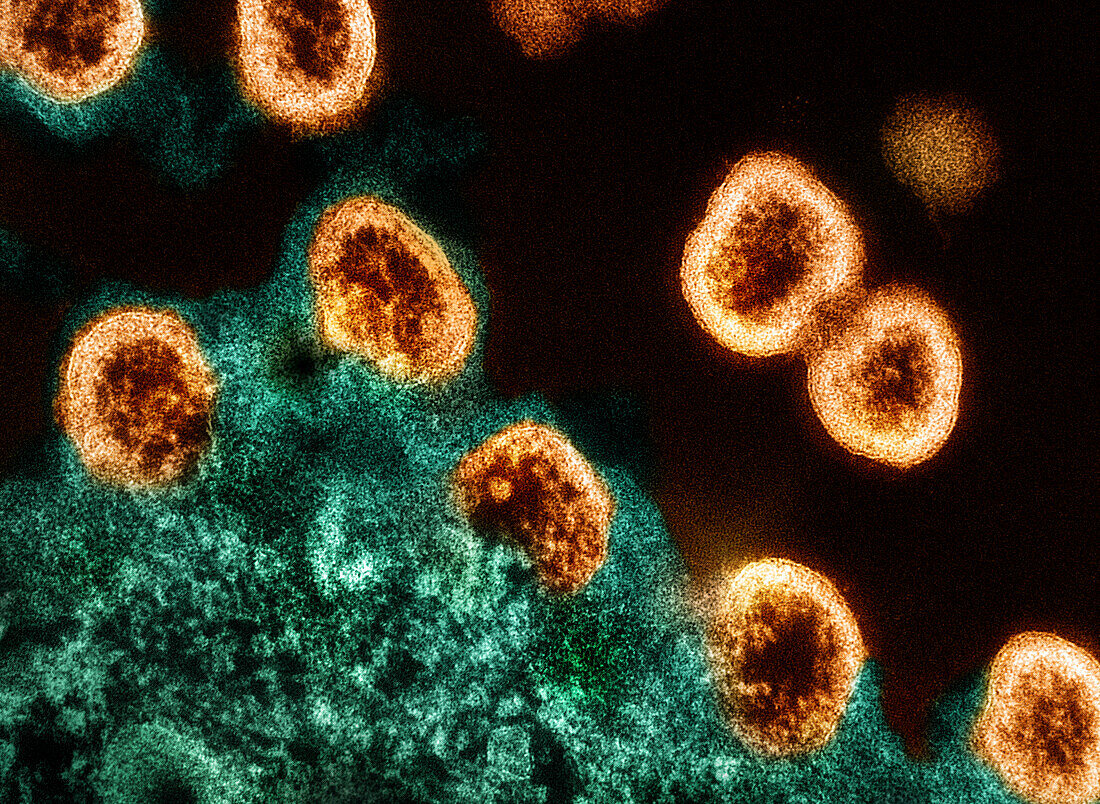 HIV-1 virus particles, TEM