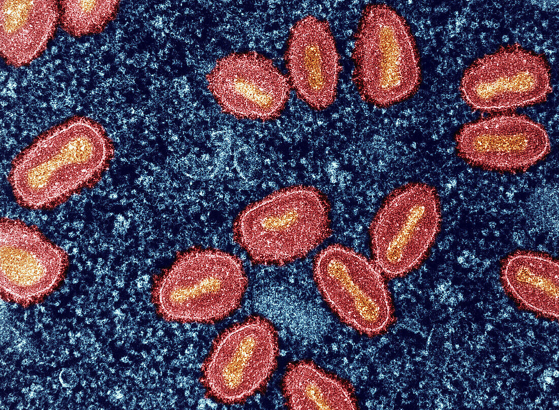 Mpox virus particles, TEM