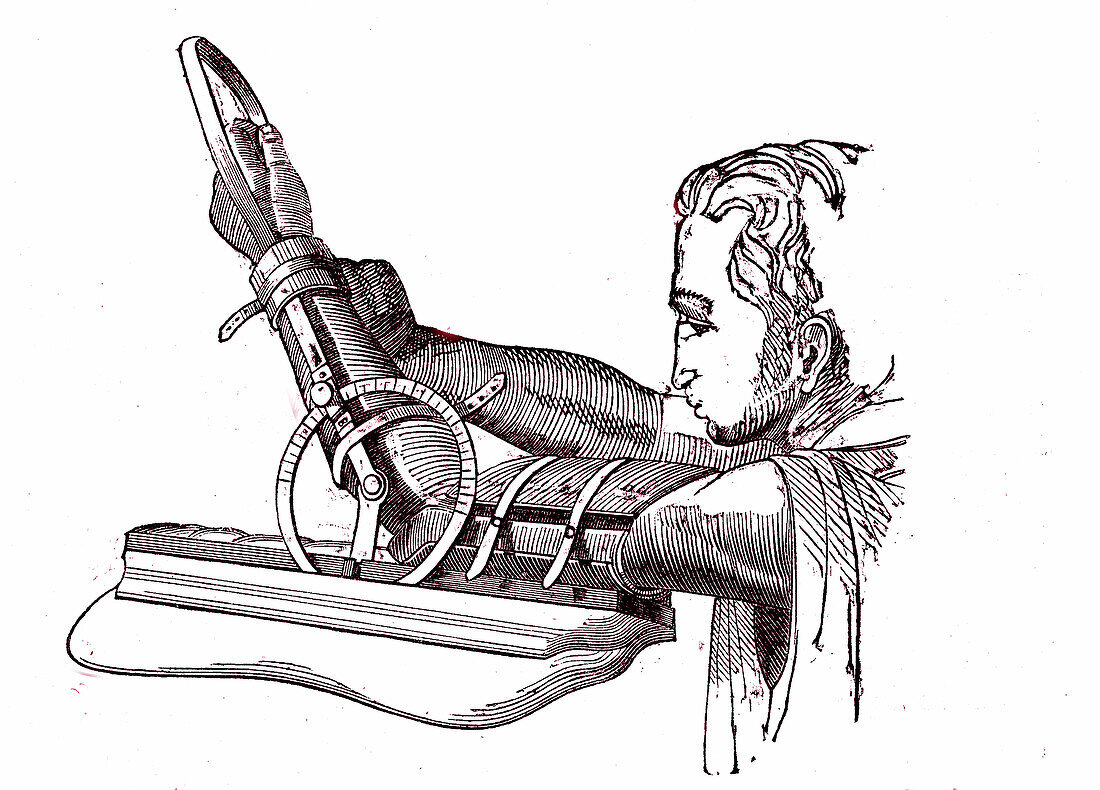 Device for flexion and extension of the arm, 19th century illustration