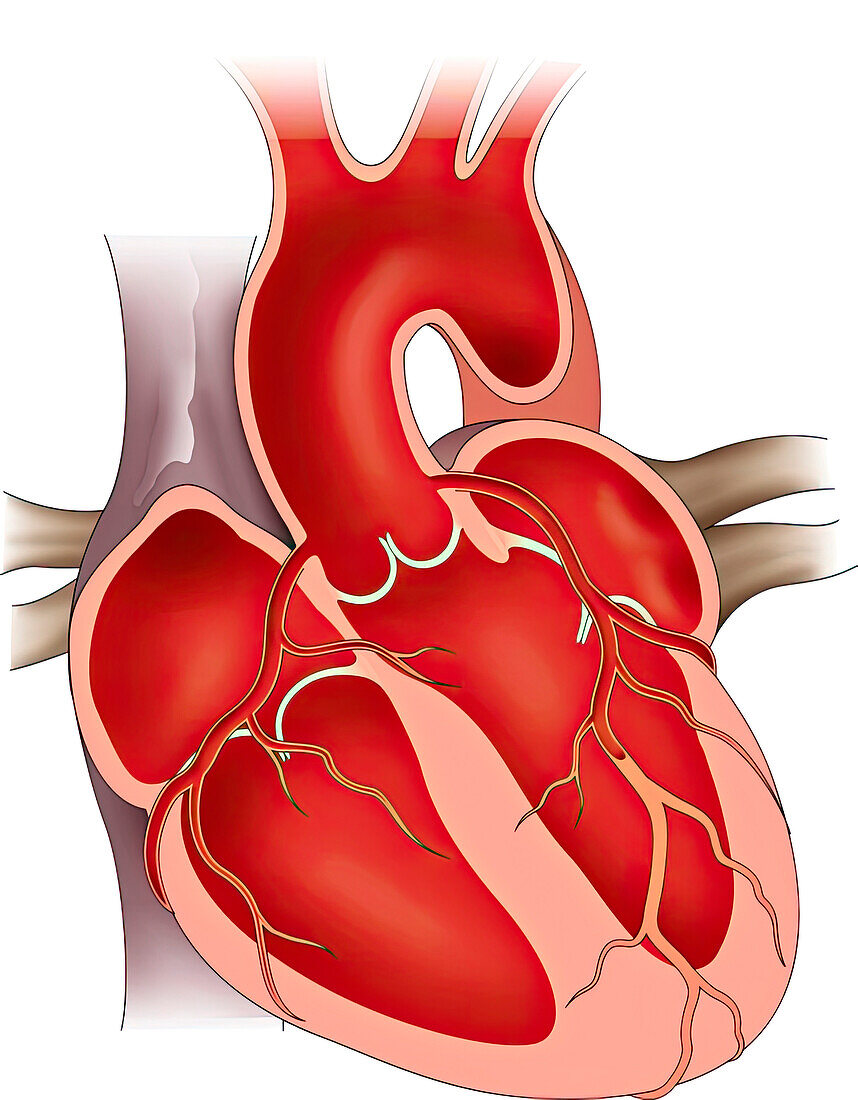 Aortic root and coronary arteries, illustration