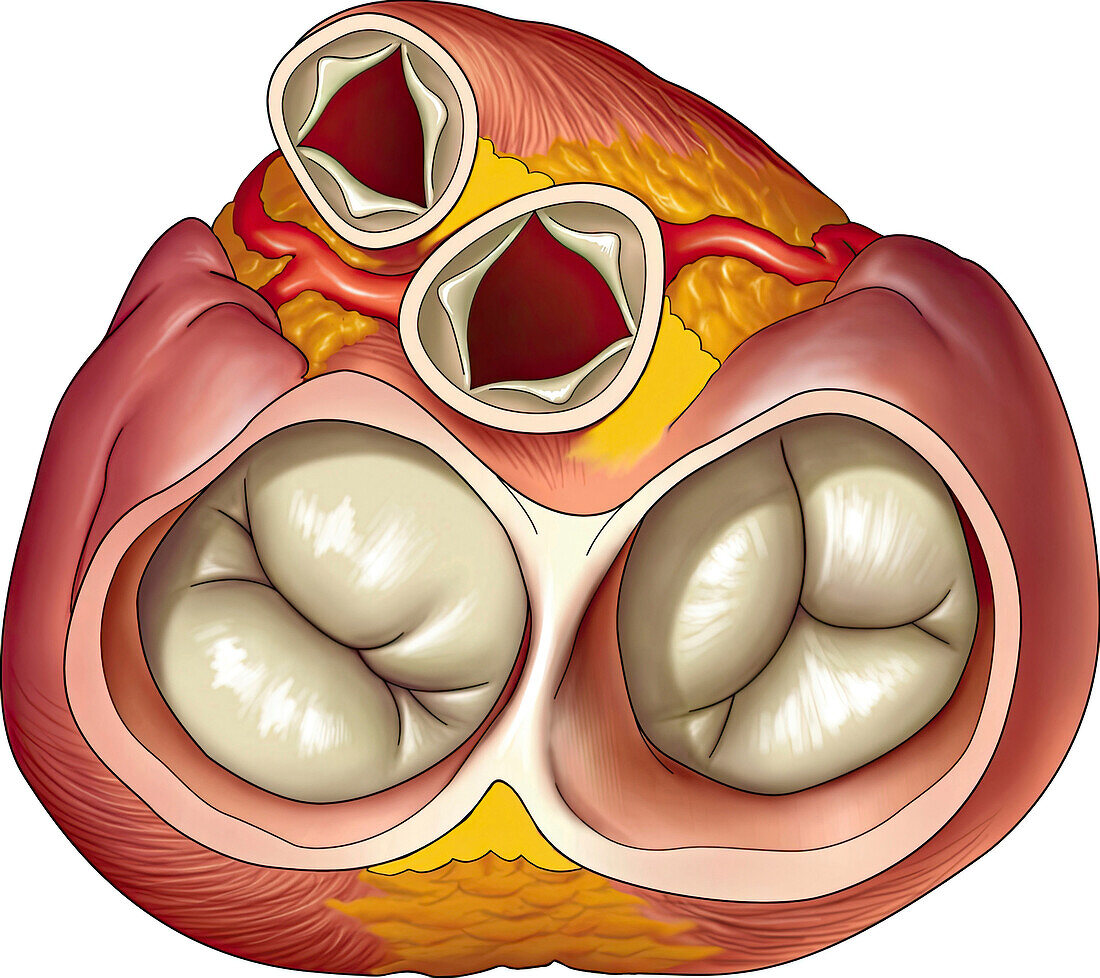 Normal heart valves, diastole, illustration