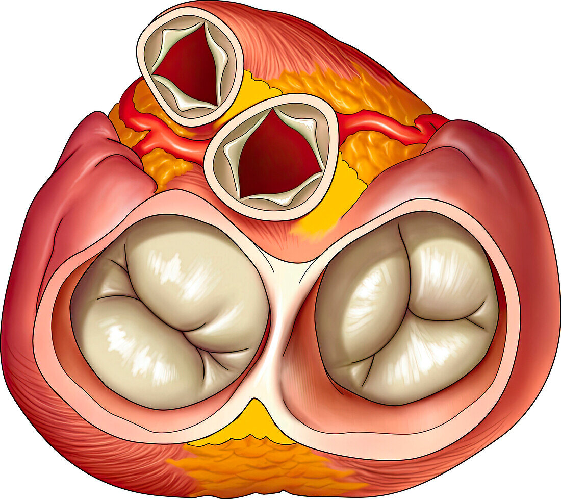 Normal heart valves, systole, illustration