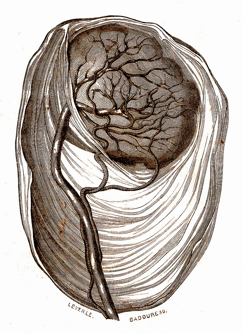 Marginal cord insertion of the placenta, 19th century illustration