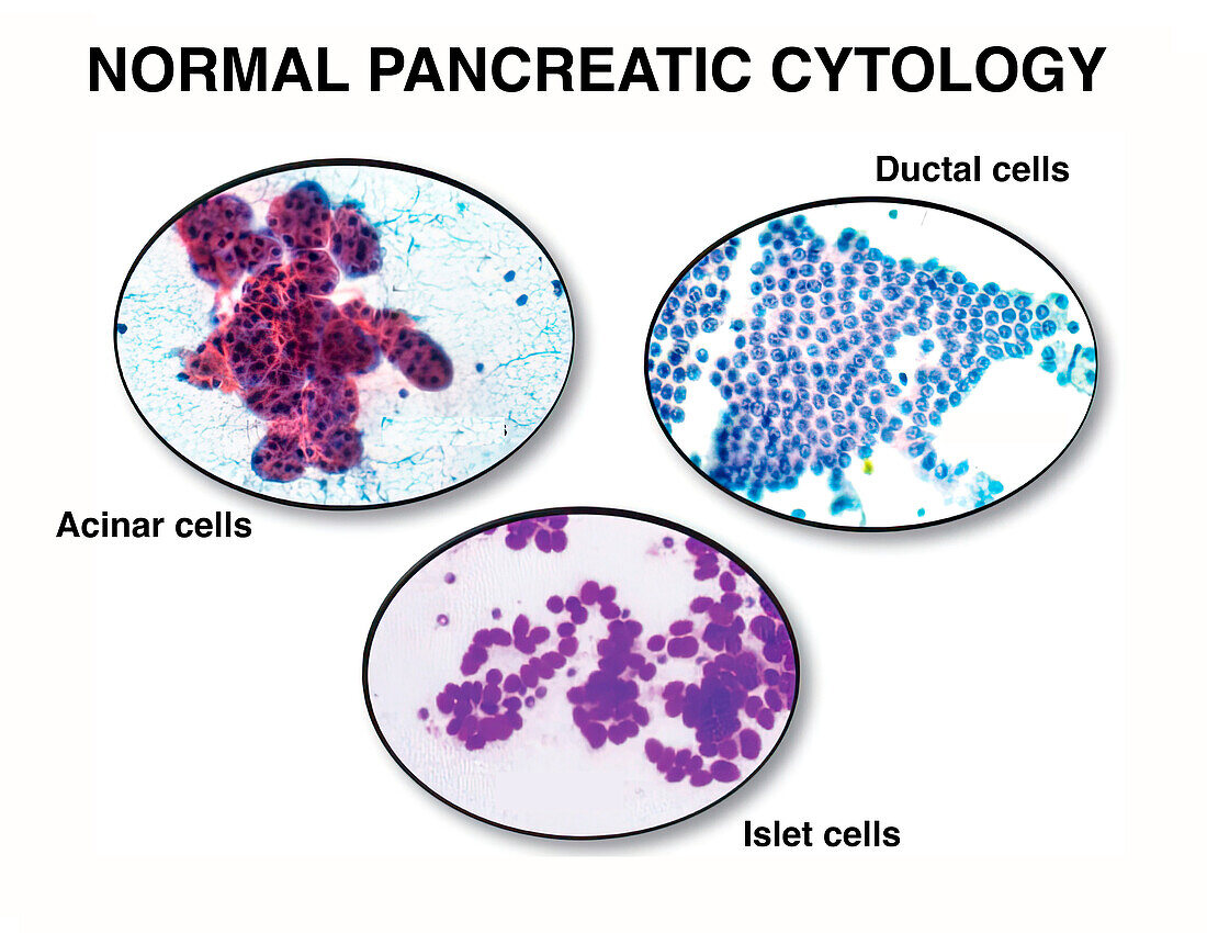 Normal pancreatic cytology, illustration