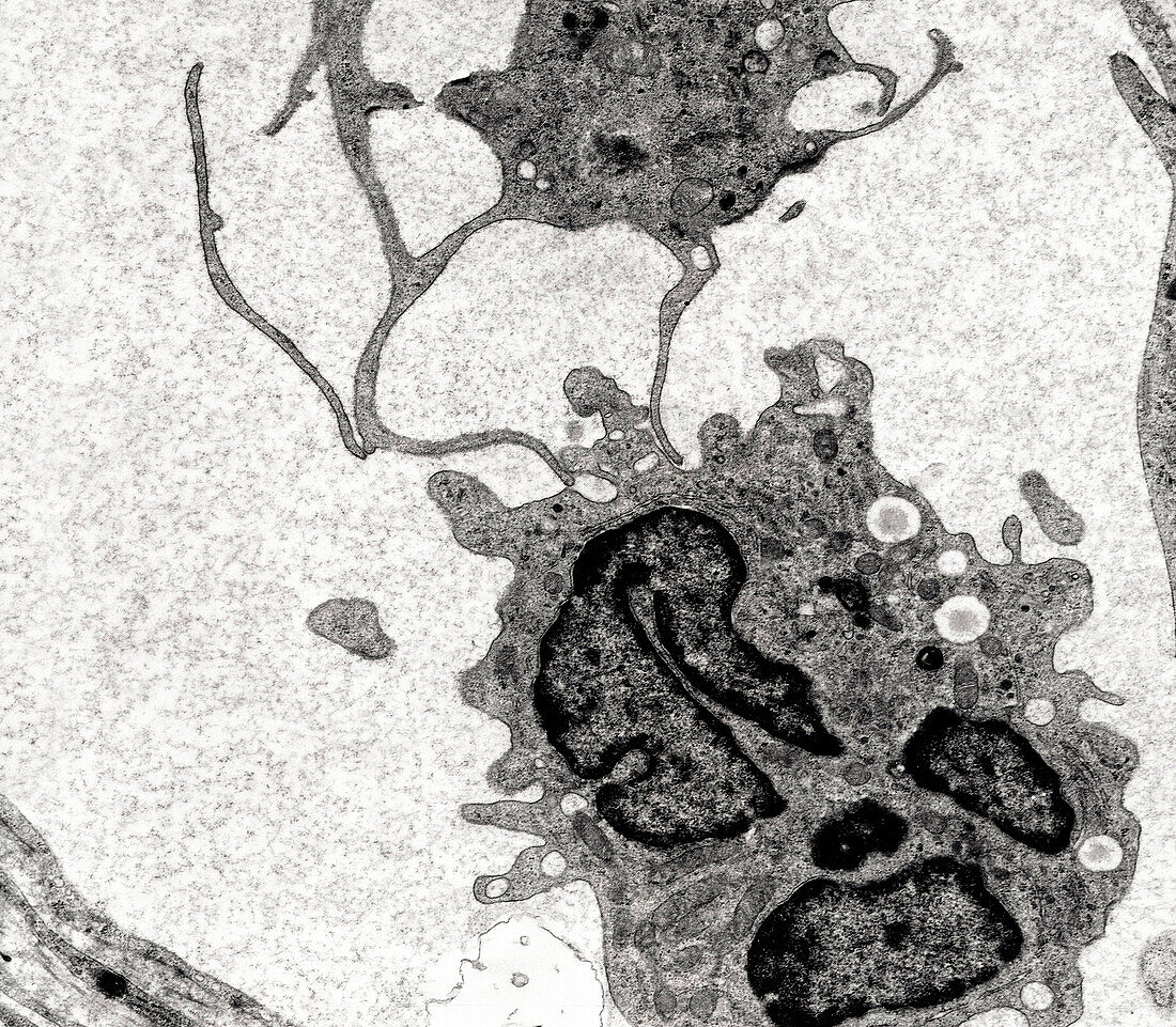Macrophages with pseudopodia, TEM