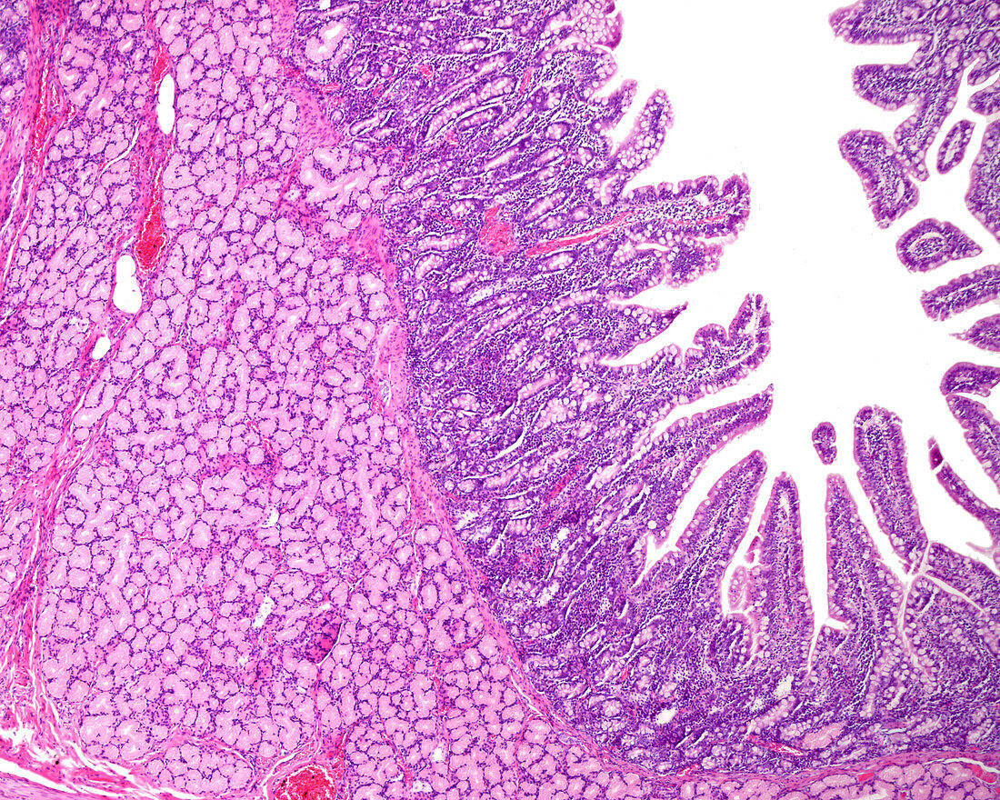 Brunner glands in duodenum, light micrograph