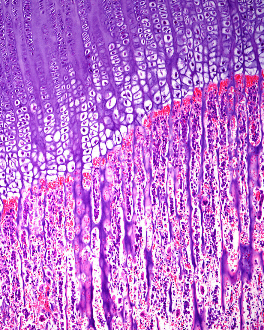 Bone epiphyseal growth plate, light micrograph