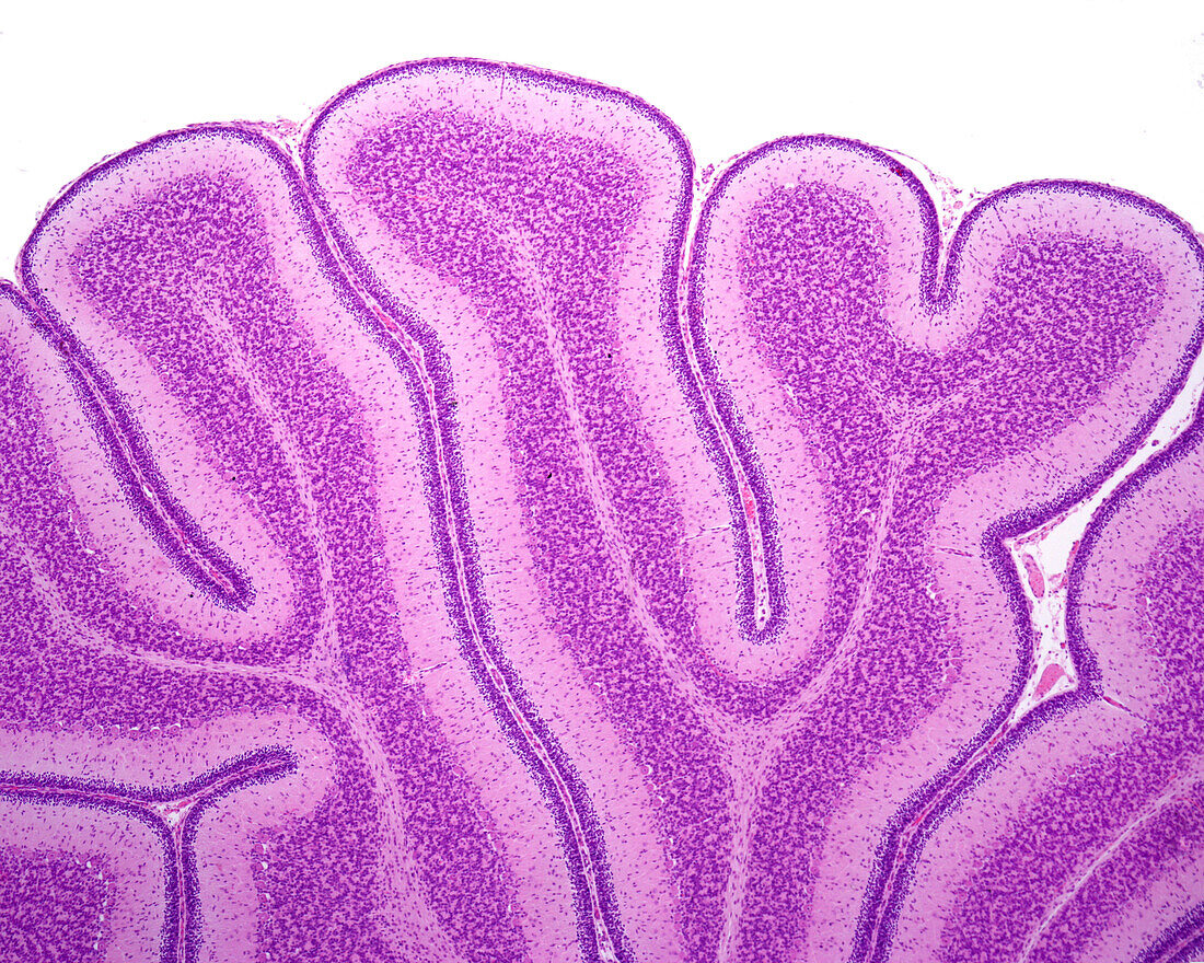 Immature cerebellum, light micrograph