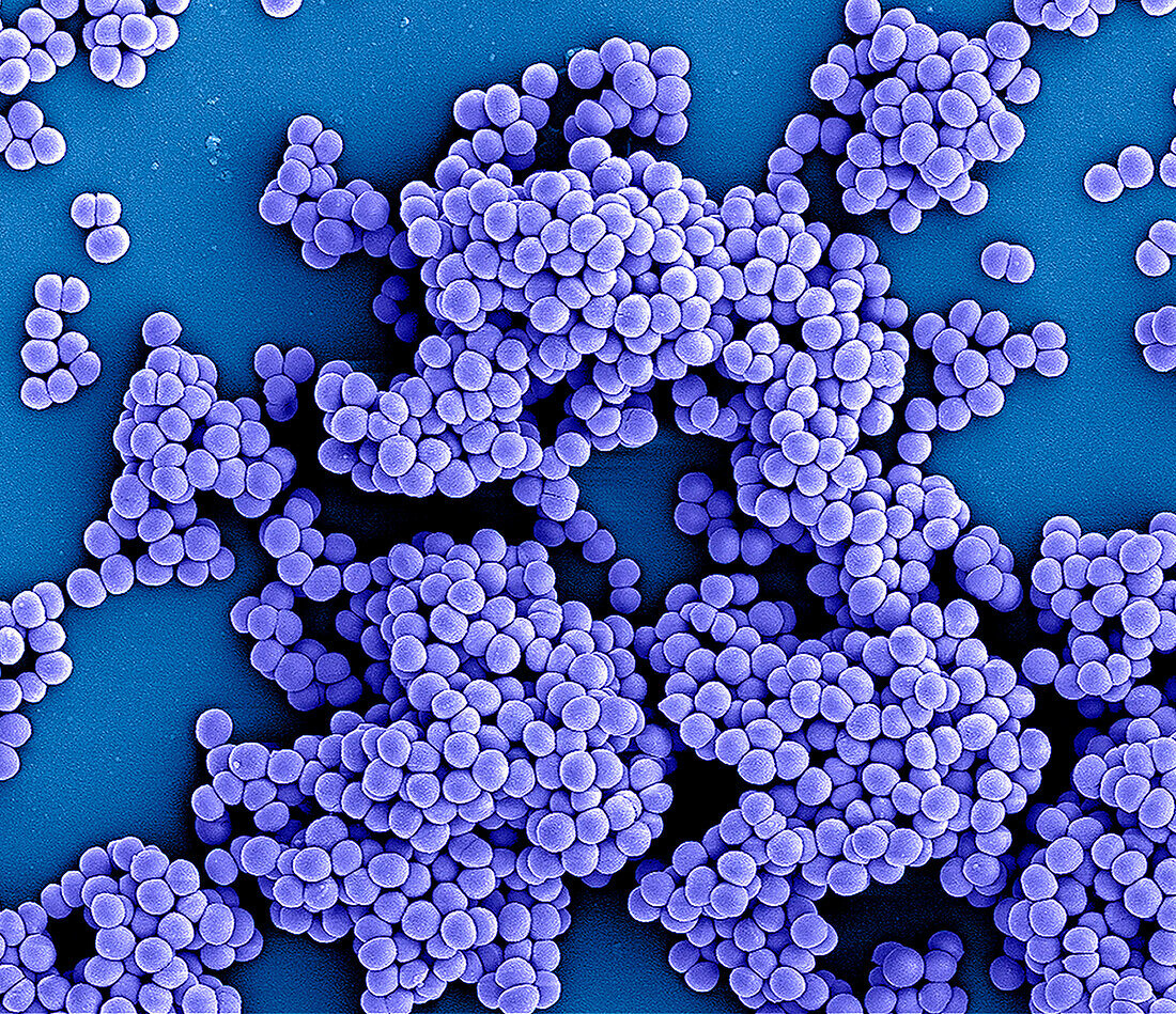 Methicillin-resistant Staphylococcus aureusbacteria, SEM