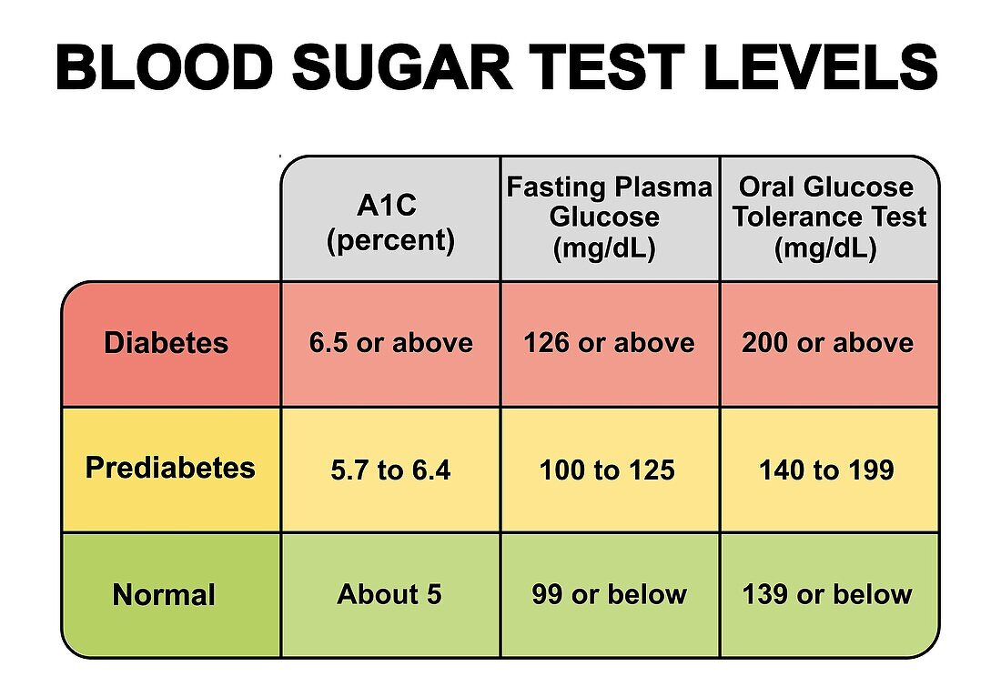 Blood sugar test levels, illustration