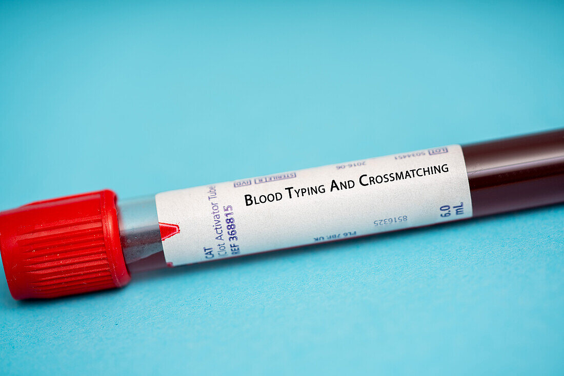 Blood typing and crossmatching
