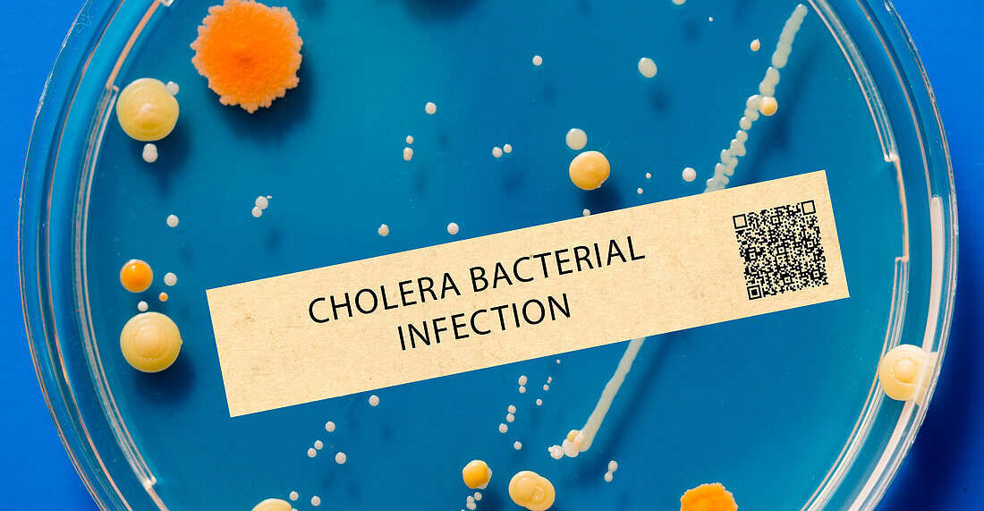 Cholera bacterial infection