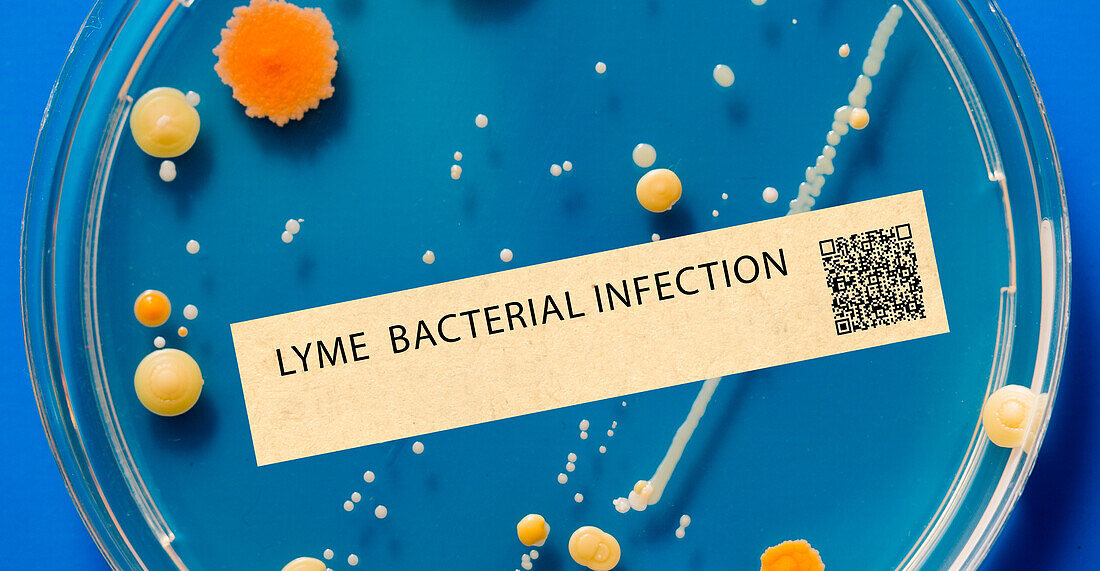 Lyme disease bacterial infection