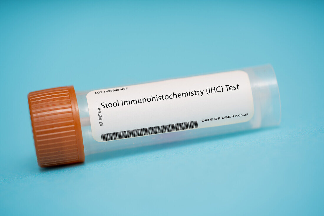 Stool immunohistochemistry test