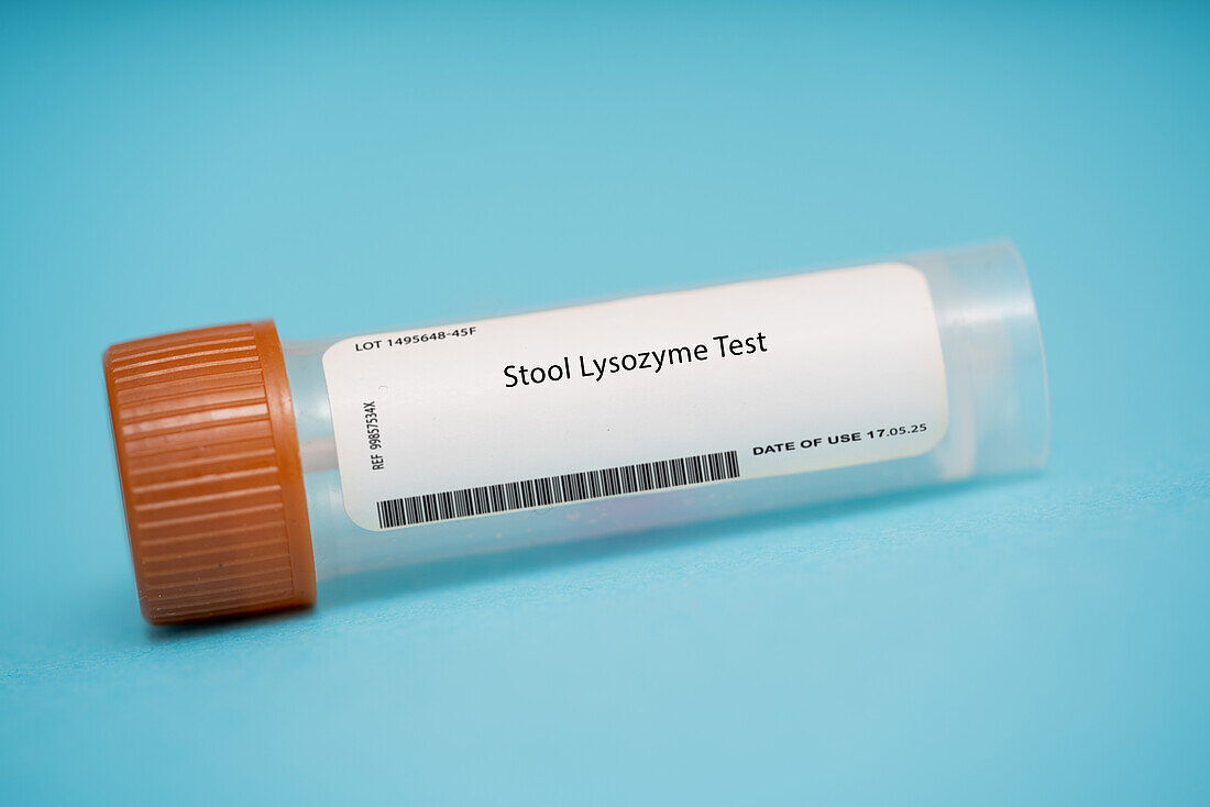 Stool lysozyme test