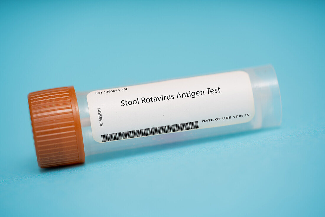 Stool rotavirus antigen test