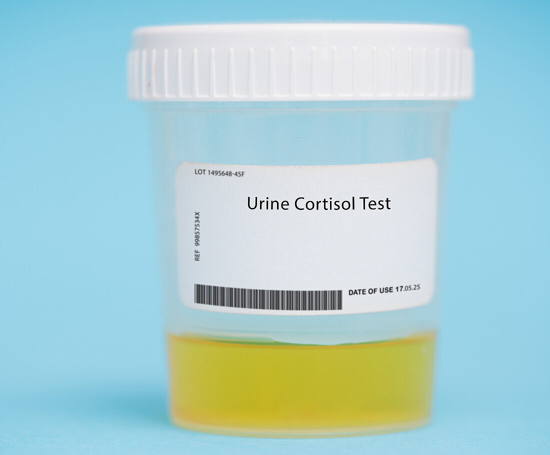 Urine cortisol test