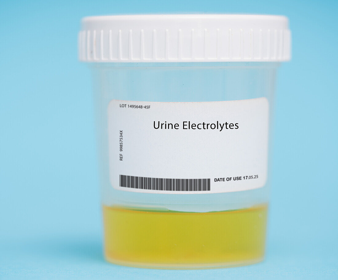 Urine electrolytes