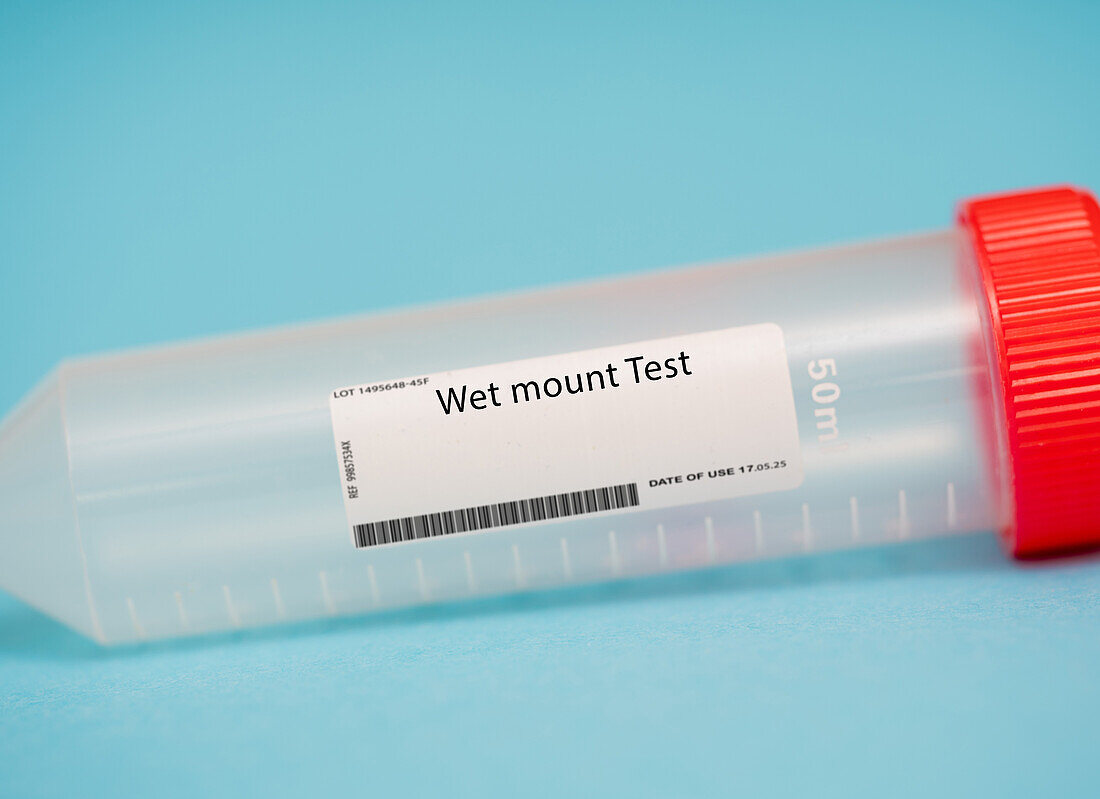 Wet mount test