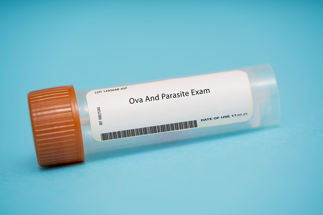 Ova and parasite exam