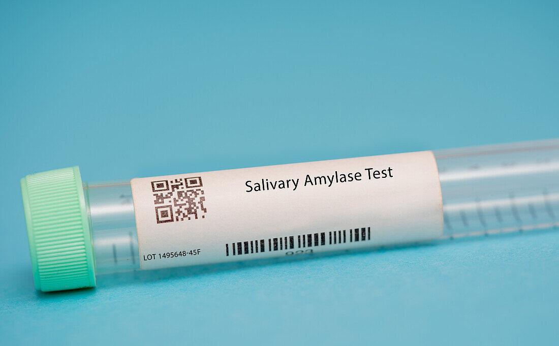 Salivary amylase test