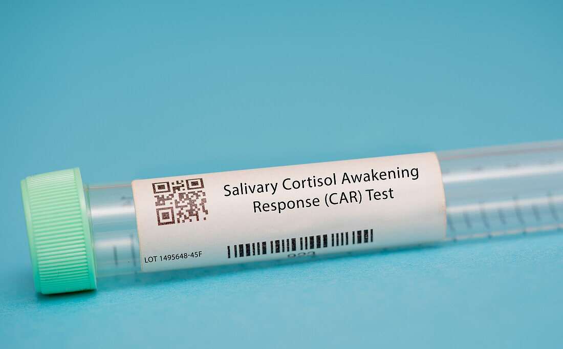 Salivary cortisol awakening response test